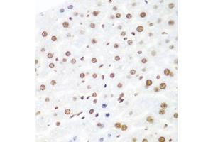 Immunohistochemistry of paraffin-embedded mouse liver using Argonaute-2 antibody (ABIN6133693, ABIN6140045, ABIN6140047 and ABIN6221669) at dilution of 1:100 (40x lens). (AGO2 antibody  (AA 1-100))