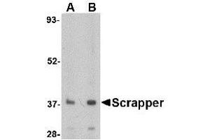 Image no. 1 for anti-F-Box and Leucine-Rich Repeat Protein 20 (FBXL20) (N-Term) antibody (ABIN1494347)