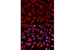 Immunofluorescence analysis of U2OS cells using SDCBP antibody. (SDCBP antibody)