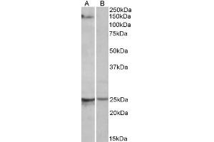 ABIN571262 (1µg/ml) staining of Mouse Heart lysate (35µg protein in RIPA buffer) with (B) and without (A) blocking with the immunising peptide. (RBM20 antibody  (AA 717-727))