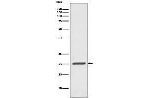 Western blot analysis of Ferritin expression in Jurkat cell lysate. (Recombinant Ferritin antibody)