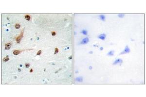Immunohistochemistry (IHC) image for anti-Adenosine Deaminase, RNA-Specific (ADAR) (C-Term) antibody (ABIN1849470) (ADAR antibody  (C-Term))