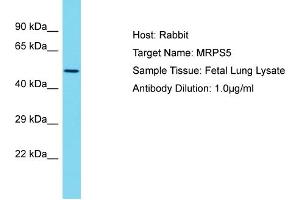 Host: Rabbit Target Name: MRPS5 Sample Type: Fetal Lung lysates Antibody Dilution: 1. (MRPS5 antibody  (N-Term))