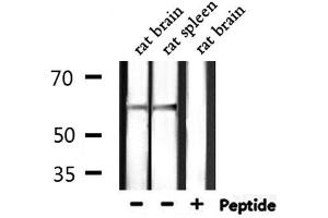 Western blot analysis of extracts from rat brain,rat spleen, using SLC9A8 Antibody. (NHE8 antibody  (C-Term))