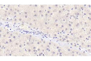 Detection of OPG in Human Liver Tissue using Monoclonal Antibody to Osteoprotegerin (OPG)