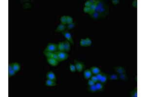 Immunofluorescent analysis of PC-3 cells using ABIN7170882 at dilution of 1:100 and Alexa Fluor 488-congugated AffiniPure Goat Anti-Rabbit IgG(H+L) (SDHA antibody  (AA 44-293))