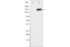 Western blot analysis of PLCG1 phosphorylation expression in EGF treated COS7 whole cell lysates,The lane on the left is treated with the antigen-specific peptide.