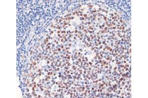 Immunohistochemistry of paraffin-embedded Human tonsil using DNMT1 Polyclonal Antibody at dilution of 1:200 (40x lens). (DNMT1 antibody)