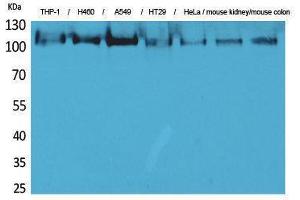 Western Blotting (WB) image for anti-Phospholipase A2, Group IVA (Cytosolic, Calcium-Dependent) (PLA2G4A) (N-Term) antibody (ABIN3187717) (PLA2G4A antibody  (N-Term))