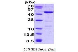 Image no. 1 for Ubiquitin Thioesterase OTU1 (YOD1) protein (His tag) (ABIN1098573)