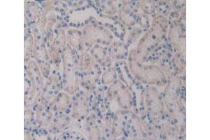 IHC-P analysis of Rat Kidney Tissue, with DAB staining. (TLR4 antibody  (AA 49-247))