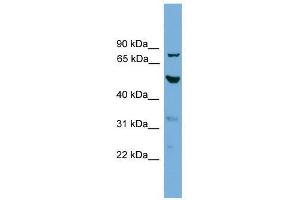 TUBA8 antibody used at 0. (TUBA8 antibody  (N-Term))