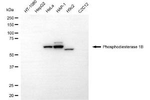 Western blotting analysis using phosphodiesterase 1B antibody (ABIN7799797).