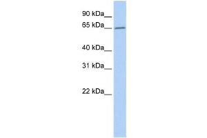 Western Blotting (WB) image for anti-Acyl-CoA Thioesterase 12 (ACOT12) antibody (ABIN2459539) (ACOT12 antibody)