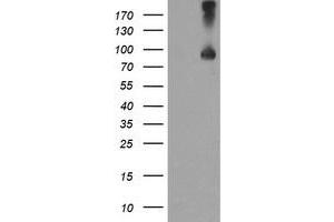 HEK293T cells were transfected with the pCMV6-ENTRY control (Left lane) or pCMV6-ENTRY TFR2 (Right lane) cDNA for 48 hrs and lysed. (Transferrin Receptor 2 antibody)