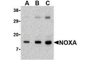 Western Blotting (WB) image for anti-Phorbol-12-Myristate-13-Acetate-Induced Protein 1 (PMAIP1) (N-Term) antibody (ABIN2475927)