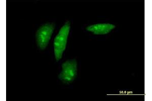 Immunofluorescence of purified MaxPab antibody to SRPK2 on HeLa cell.