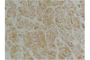 Immunohistochemistry (IHC) analysis of paraffin-embedded Mouse Skeletal Muscle Tissue using Desmin(Monoclonal Antibody diluted at 1:200. (Desmin antibody)