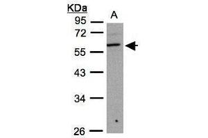 WB Image Sample(30 ug whole cell lysate) A:293T 10% SDS PAGE antibody diluted at 1:1000 (B3GNT3 antibody)