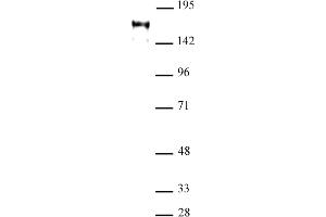 ATAD2 antibody  (C-Term)