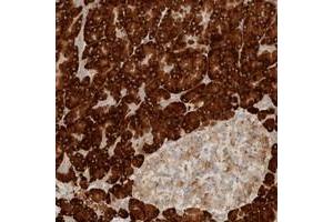 Immunohistochemical staining of human pancreas with CCDC144A polyclonal antibody  shows strong cytoplasmic positivity in exocrine cells at 1:200-1:500 dilution. (CCDC144A antibody)
