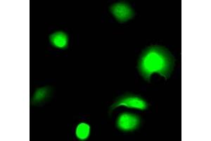 Immunofluorescence staining of MCF7 Cells with ABIN7127508 at 1:50, counter-stained with DAPI. (Recombinant Galectin 3 antibody)