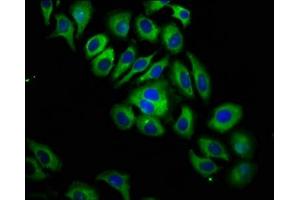 Immunofluorescence staining of A549 cells with ABIN7156494 at 1:133, counter-stained with DAPI. (ITGB6 antibody  (AA 451-586))