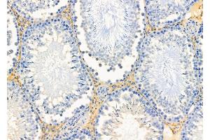 ABIN6256907 and ABIN6274858 at 1/100 staining Rat testis tissue by IHC-P. (Apolipoprotein L 4 antibody  (C-Term))