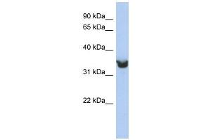 DLK1 antibody used at 1 ug/ml to detect target protein. (DLK1 antibody)