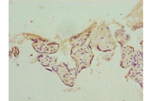 PSMD1 antibody  (Regulatory Subunit 10)