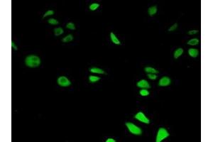 Detection of HIF1aN in Human Hela Cells using Polyclonal Antibody to Hypoxia Inducible Factor 1 Alpha Subunit Inhibitor (HIF1aN) (HIF1AN antibody  (AA 31-349))