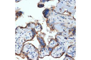 Immunohistochemistry of paraffin-embedded human placenta using NLK Rabbit mAb (ABIN7268846) at dilution of 1:100 (40x lens). (Nemo-Like Kinase antibody)