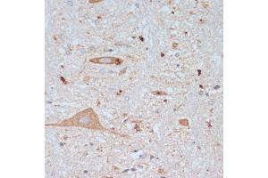 Immunohistochemistry of paraffin-embedded rat brain using SLC18 antibody (ABIN7270410) at dilution of 1:200 (40x lens). (SLC18A3 antibody  (AA 1-150))