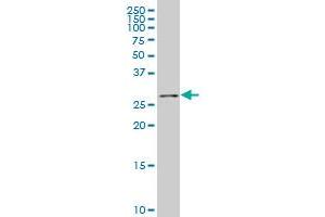 RPP30 polyclonal antibody (A01), Lot # 060525JCS1. (RPP30 antibody  (AA 169-268))