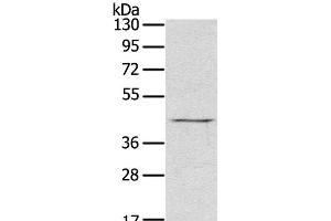 Western Blot analysis of Raji cell using RASSF7 Polyclonal Antibody at dilution of 1:800 (RASSF7 antibody)
