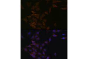 Immunofluorescence analysis of C6 cells using PP2A alpha + beta Rabbit mAb (ABIN7269686) at dilution of 1:100 (40x lens). (PPP2CB antibody)