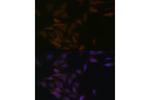 Immunofluorescence analysis of C6 cells using PP2A alpha + beta Rabbit mAb (ABIN7269686) at dilution of 1:100 (40x lens). (PPP2CB antibody)