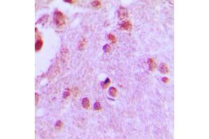 Immunohistochemical analysis of CDC46 staining in human brain formalin fixed paraffin embedded tissue section. (MCM5 antibody  (N-Term))