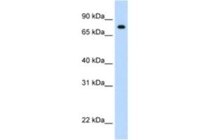 Western Blotting (WB) image for anti-Signal Transducer and Activator of Transcription 1, 91kDa (STAT1) antibody (ABIN2461816)