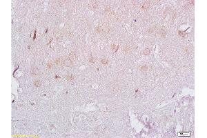 Formalin-fixed and paraffin embedded rat brain labeled with Rabbit Anti ADRB3/beta 3 Adrenergic Receptor Polyclonal Antibody, Unconjugated  at 1:200 followed by conjugation to the secondary antibody and DAB staining (ADRB3 antibody  (AA 310-408))