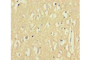 Immunohistochemistry of paraffin-embedded human brain tissue using ABIN7145308 at dilution of 1:100