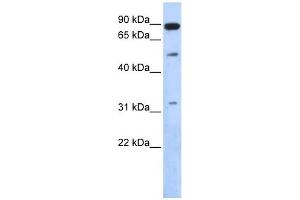 SENP5 antibody used at 1 ug/ml to detect target protein. (SENP5 antibody  (Middle Region))