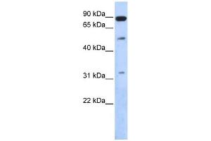 SENP5 antibody used at 1 ug/ml to detect target protein.