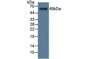 Figure. (MMP19 antibody  (AA 98-508))
