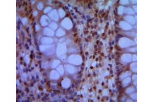 Immunohistochemistry (IHC) image for anti-Structural Maintenance of Chromosomes 1A (SMC1A) antibody (ABIN969406)