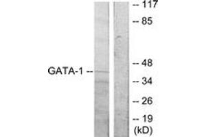 Western Blotting (WB) image for anti-GATA Binding Protein 1 (Globin Transcription Factor 1) (GATA1) (AA 277-326) antibody (ABIN2888995) (GATA1 antibody  (AA 277-326))