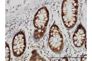 Immunoperoxidase of monoclonal antibody to SRPK1 on formalin-fixed paraffin-embedded human colon. (SRPK1 antibody  (AA 371-470))