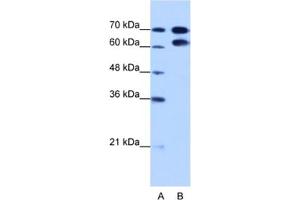 Western Blotting (WB) image for anti-Ribonucleoprotein, PTB-Binding 1 (RAVER1) antibody (ABIN2462325)