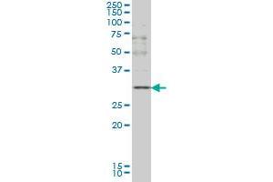 CD40LG monoclonal antibody (M01), clone 2E2 Western Blot analysis of CD40LG expression in K-562 . (CD40 Ligand antibody  (AA 101-203))