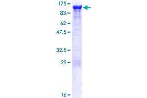 Image no. 1 for Actinin, alpha 4 (ACTN4) (AA 1-911) protein (GST tag) (ABIN1305772)